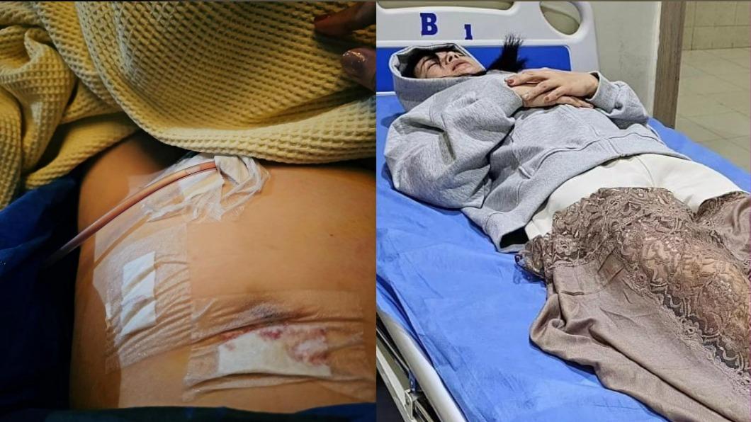 腹痛驚罹闌尾炎險死!台8女星拍打戲又驚吐「上下都冒血」