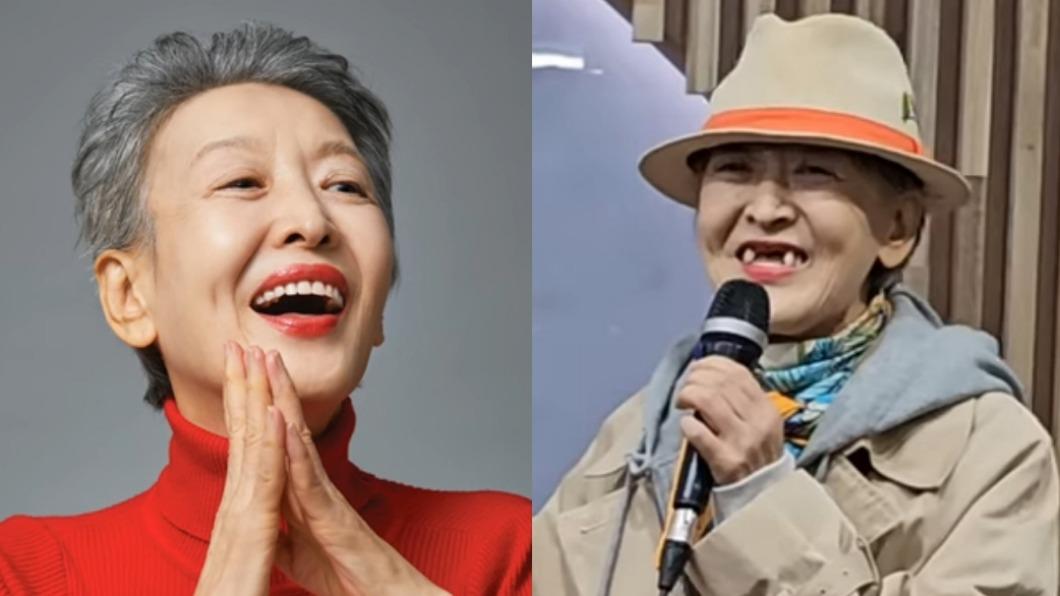 67歲影后患腦瘤「4顆門牙掉光」! 催淚原因讓她術後拒化療