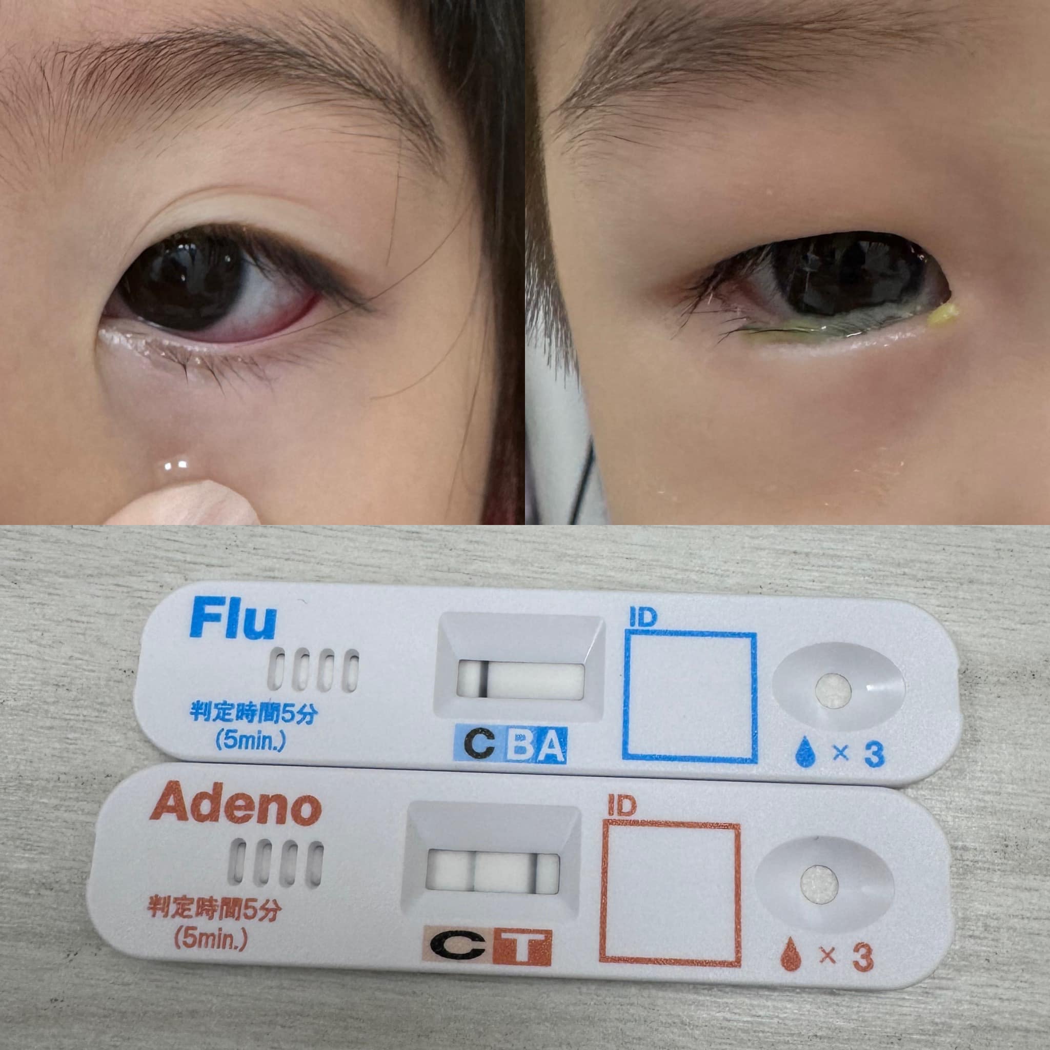 門診有不少孩子感染「燒久姬」病毒。（圖／翻攝自雙寶爸的小宇宙｜兒童感染科 顏俊宇醫師臉書）