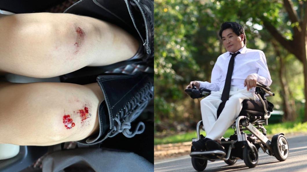 資深男星手腿萎縮無法自理!女兒為抱父「慘摔濺血」 自責:我害的