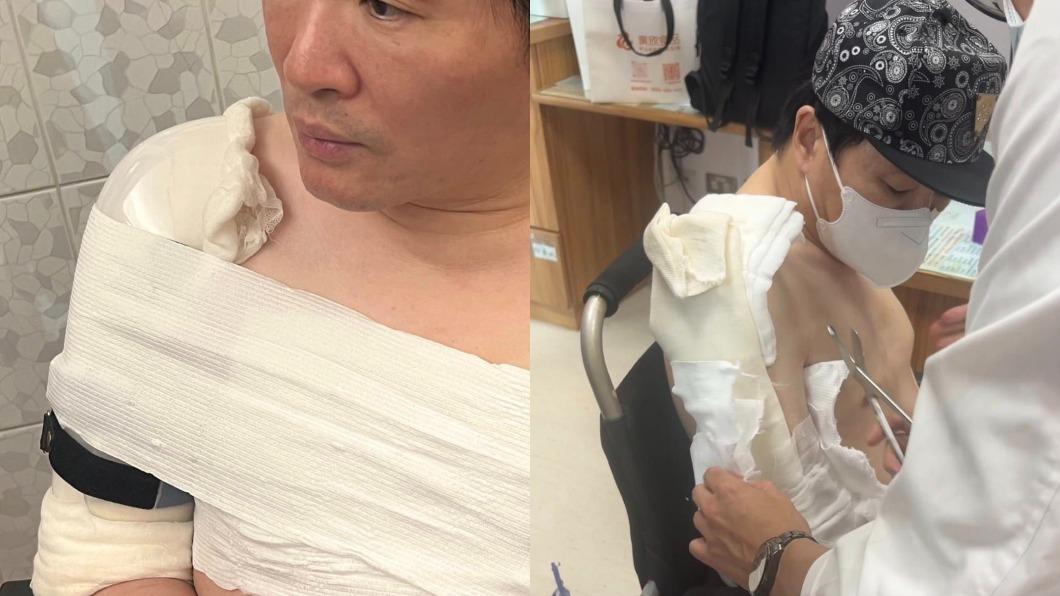 蔡義德8月出席活動不慎遭粉絲拖倒在地，造成右上臂骨頭斷裂。（圖／翻攝自蔡義德臉書）