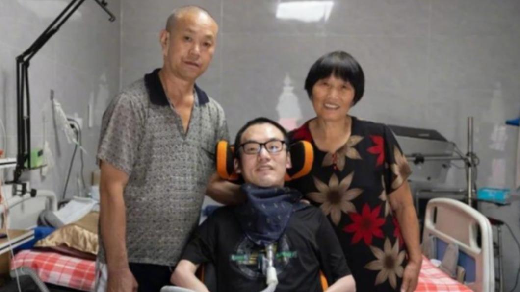 網紅卓君爆死訊!漸凍症侵蝕病逝 曾被斷言「活不過20歲」