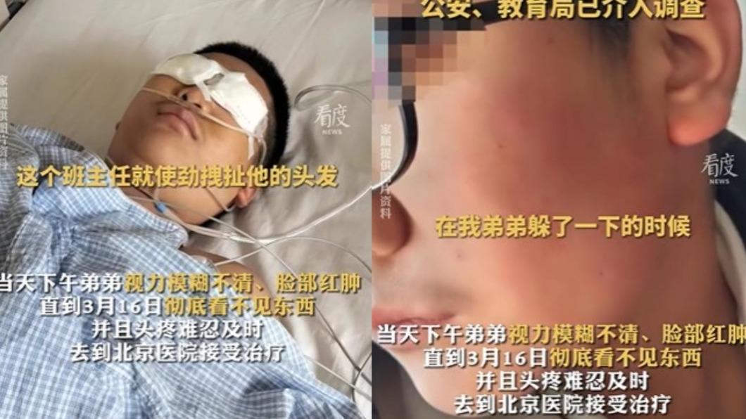 作業寫錯「被揍到失明」!疑遭班導怒毆 小五弟眼球恐萎縮