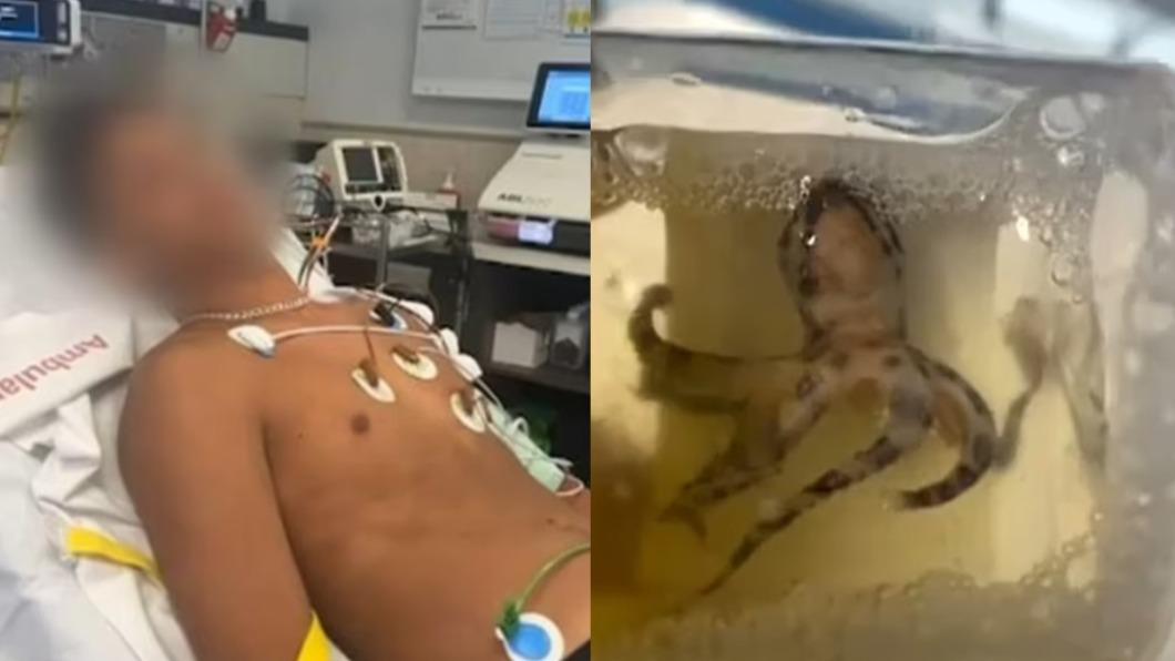 比氰化鉀毒1千倍!撿貝殼突竄「藍環章魚」 少年遭咬傷險死