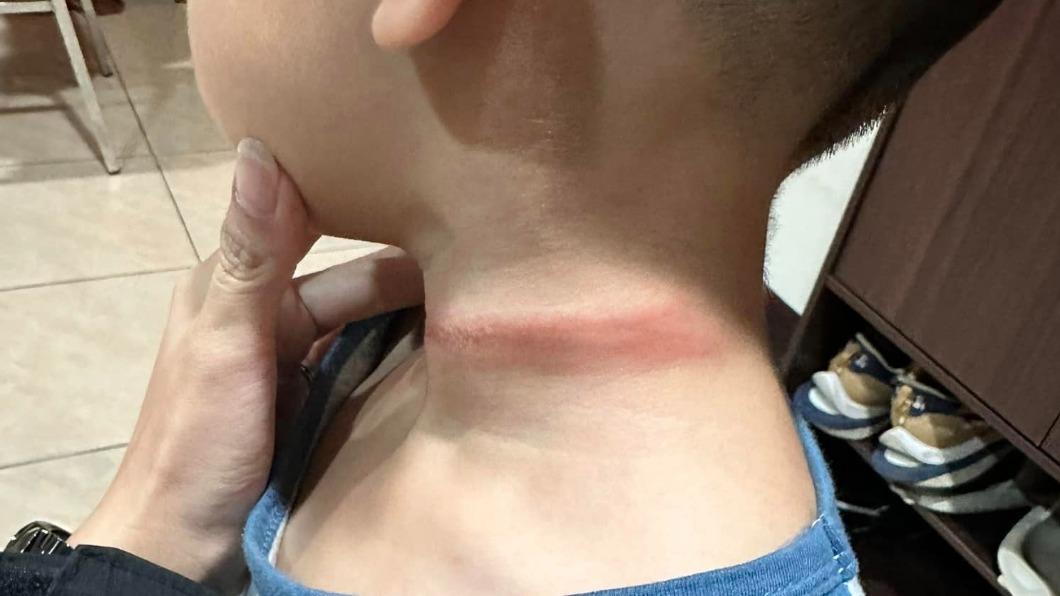 男童「繩索勒脖」拖行 家長控幼教師滑手機還教小孩說謊