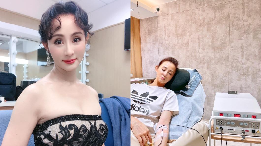 手術前慶生!50歲本土劇女星「罹癌開刀續命」 終身得服藥