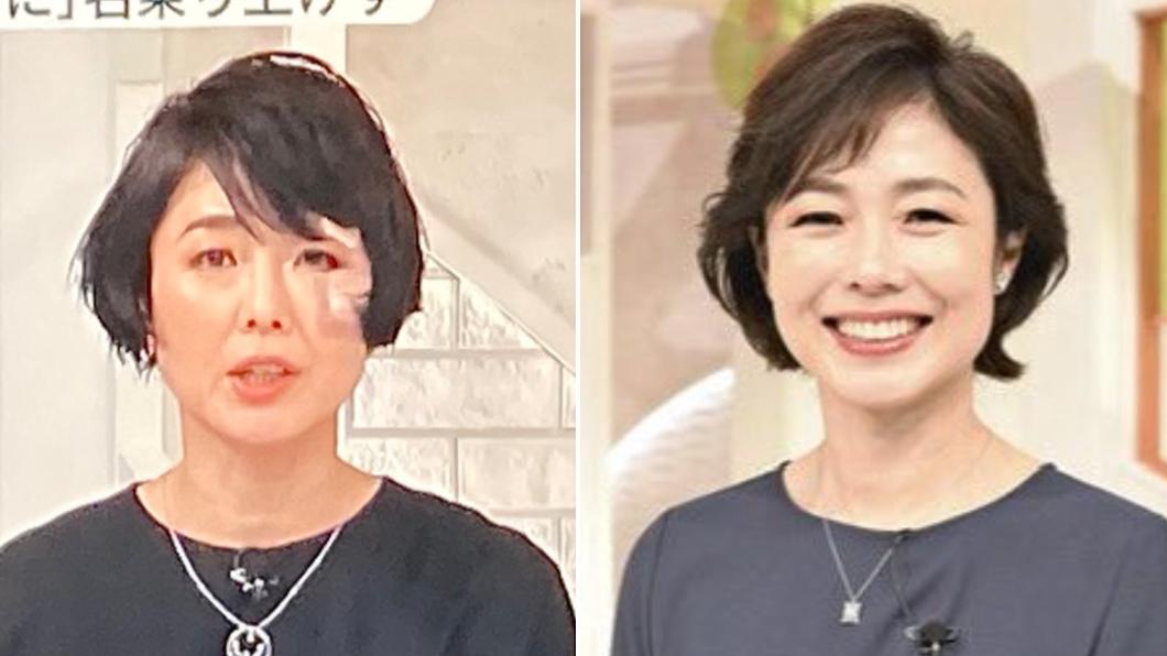 日本美女主播宿醉慘摔! 撞傷臉蛋上節目苦笑:尾牙要小心
