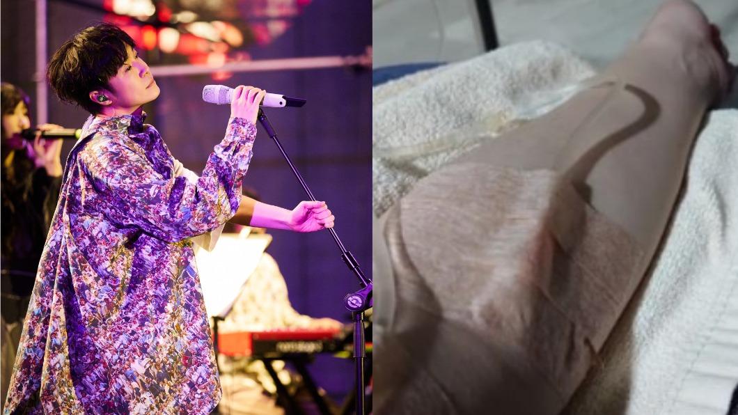 蘇打綠才宣布回歸!青峰突曬「點滴照」嘆:今年第三次