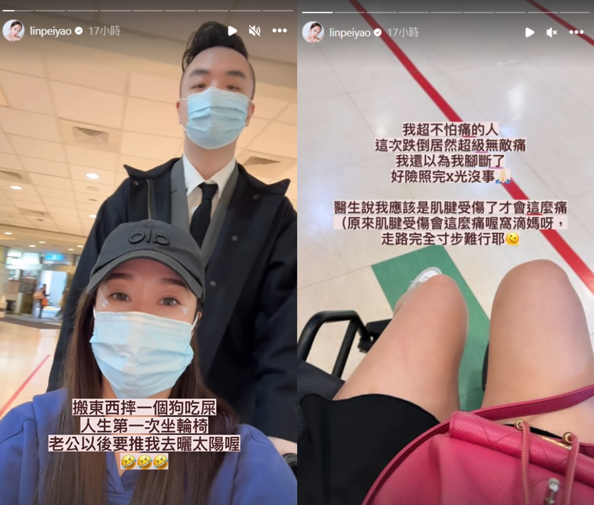 林佩瑤搬東西不慎跌倒受傷,目前須由輪椅代步。(圖/翻攝自林佩瑤IG)