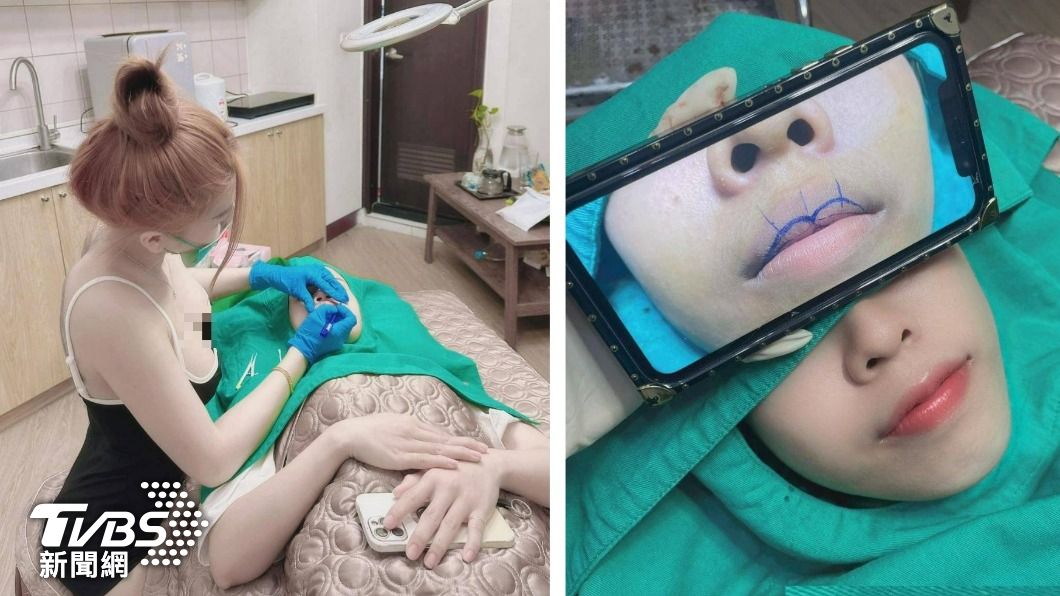 逃逸7年!超辣越南小姐姐成「整形密醫」 豐胸隆鼻賺百萬