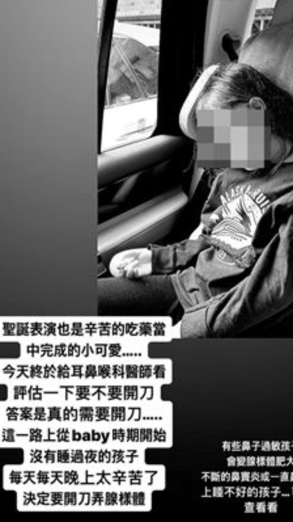 宋米秦愛女罹「腺樣體肥大」需開刀。（圖／翻攝自宋米秦臉書）