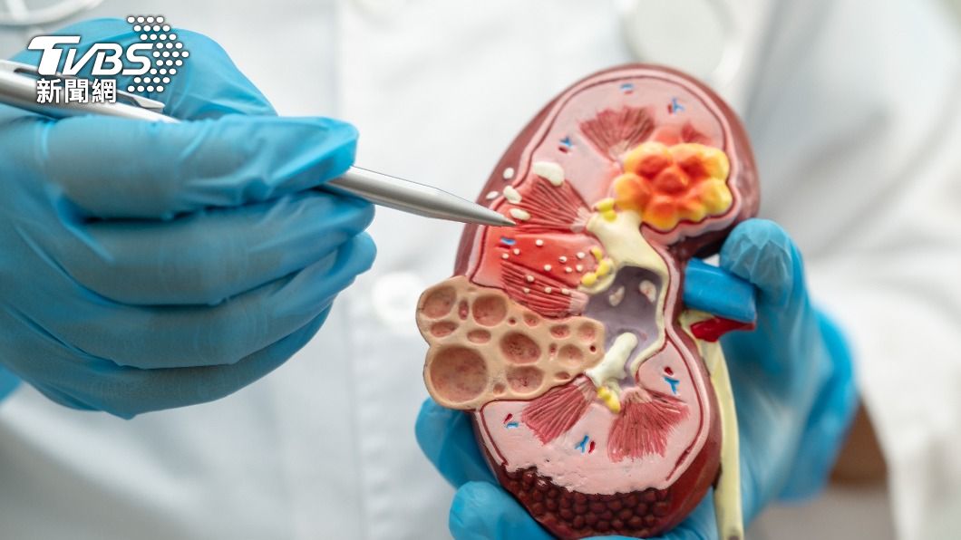 蛋白尿越嚴重的人腎功能退化的速度就越快。（示意圖／shutterstock達志影像）
