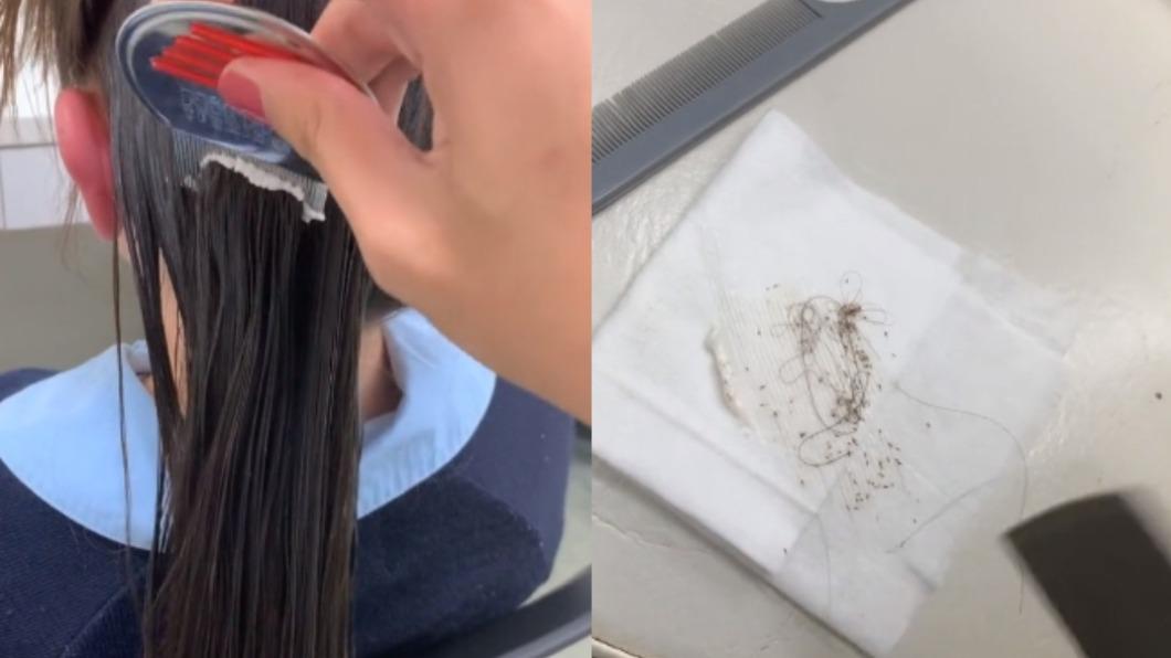 少女秀髮黏滿「上百顆頭蝨」!一梳開狂蠕動 超噁影片曝