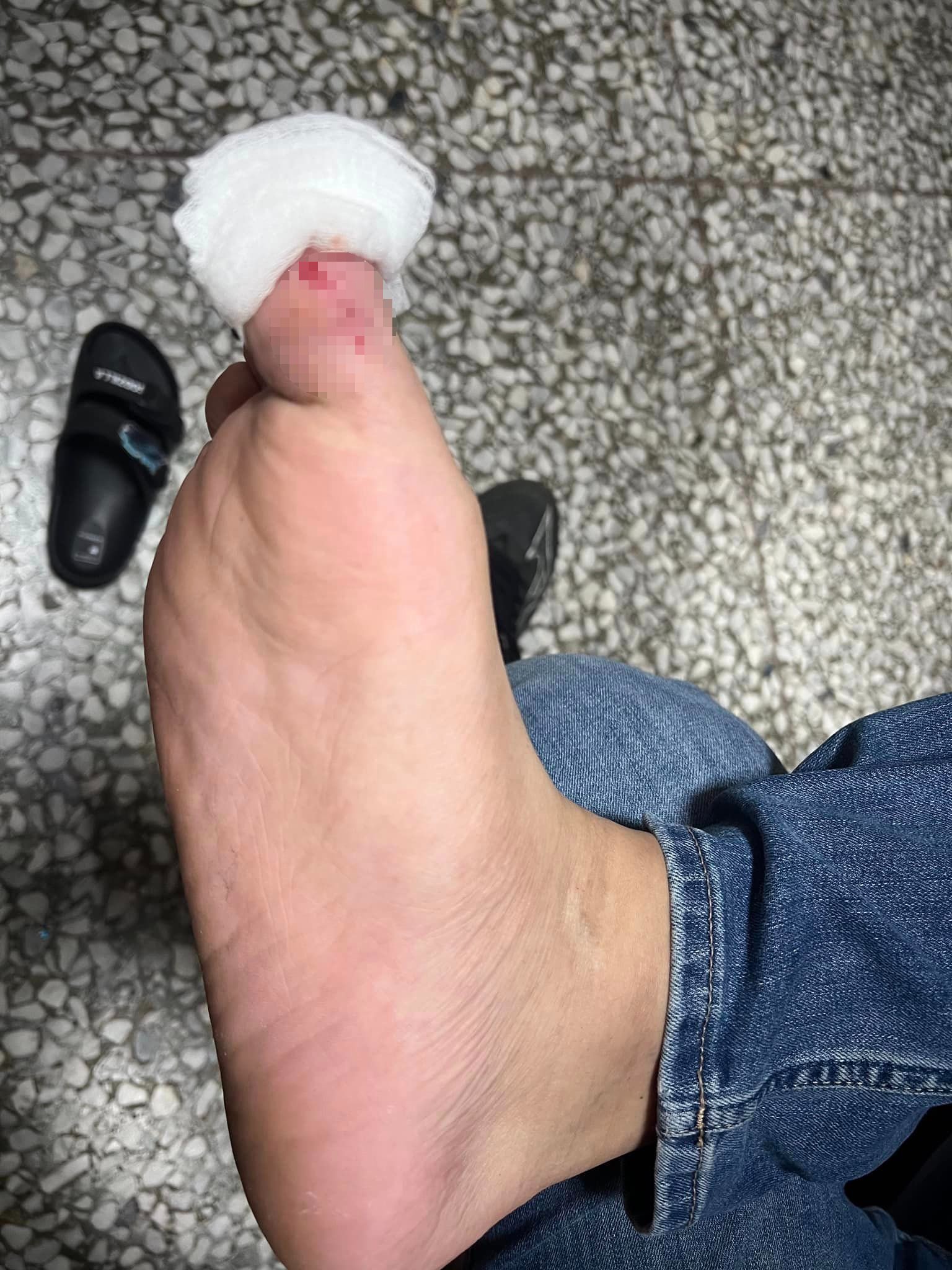 消費者腳底遭到溫泉池底刮傷。（圖／翻攝自花蓮同鄉會臉書社團）