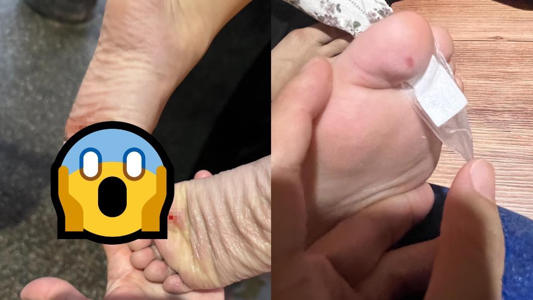 泡湯出事！7孩2大人遭割傷「腳底滲血」　業者火速致歉