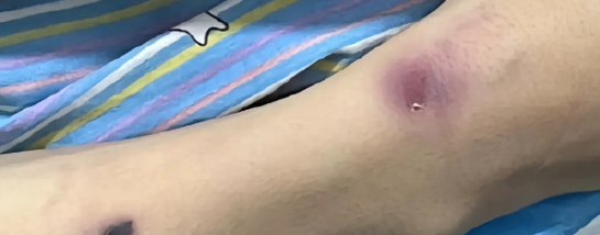 家屬懷疑孩子遭毆打,學校堅稱跳樓輕生。(圖/翻攝自上游新聞微博)