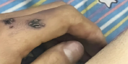 楊同學手遭螺絲起子貫穿,有明顯外傷。(圖/翻攝自上游新聞微博)
