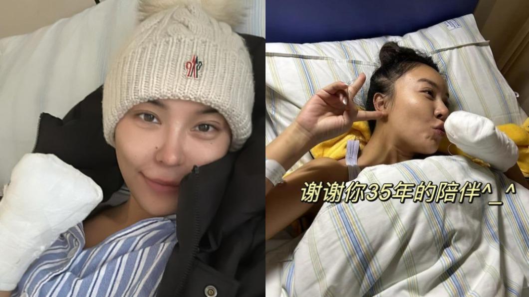 消失2個月!35歲名模驚爆「左手截肢」 割頭皮急動刀搶命