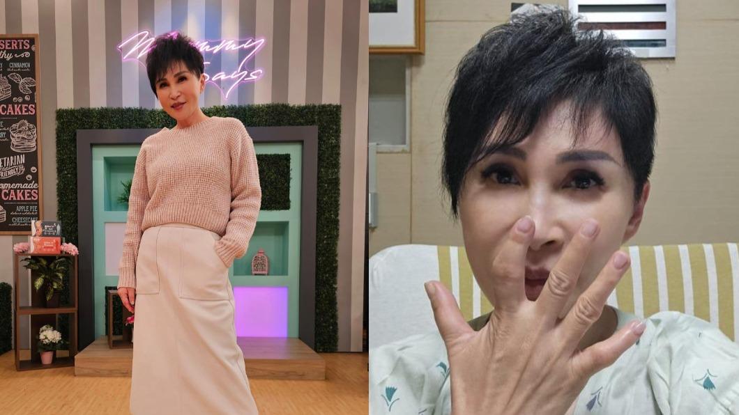 王瑞玲44歲起發現手指關節開始變形，服藥、動手術飽受紅斑性狼瘡之苦。（圖／翻攝自王瑞玲醫藥美食記者臉書）