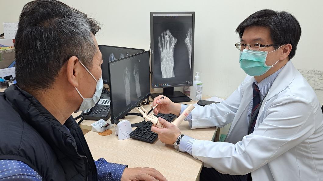中老年注意!每5人就1人中招 腳變形踩地走路都痛爆