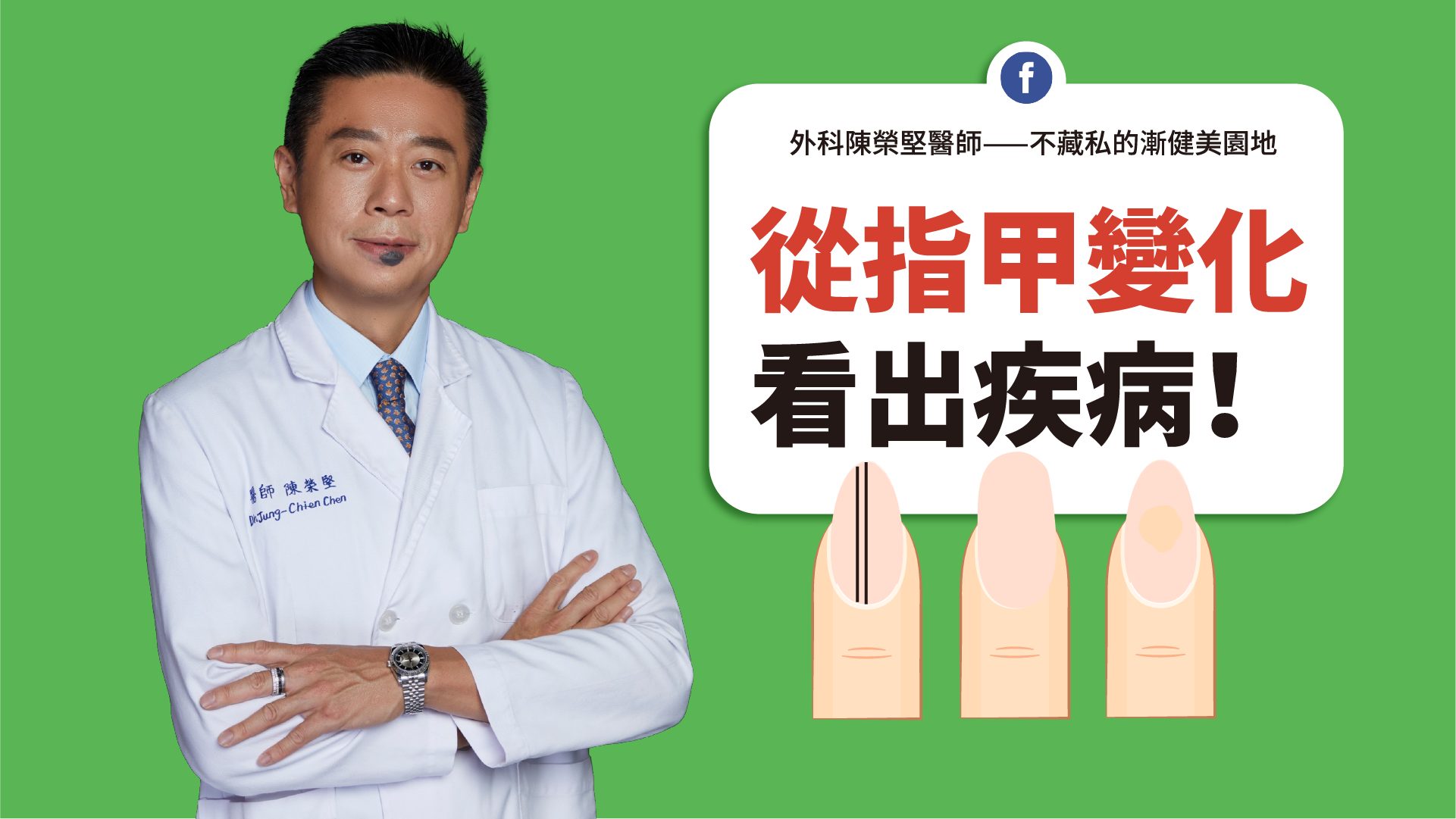 指甲黑線不均勻、容易滲血,恐是惡性腫瘤。(圖/翻攝自陳榮堅臉書)