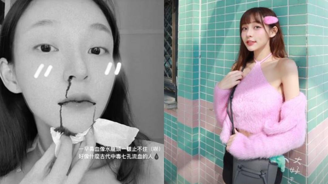 林襄在IG曬出狂流鼻血照,令粉絲們心疼不已。(圖/翻攝自林襄IG)