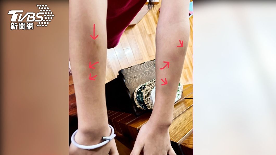 獨/新北小學爆霸凌!遭同學栽贓小偷捏到瘀青 教育局:校方行政失職