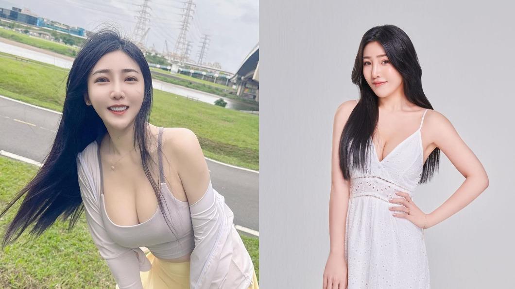 國光女神面癱!吃東西漏風流出、一眼閉不起 患罕病恐「康復不了」