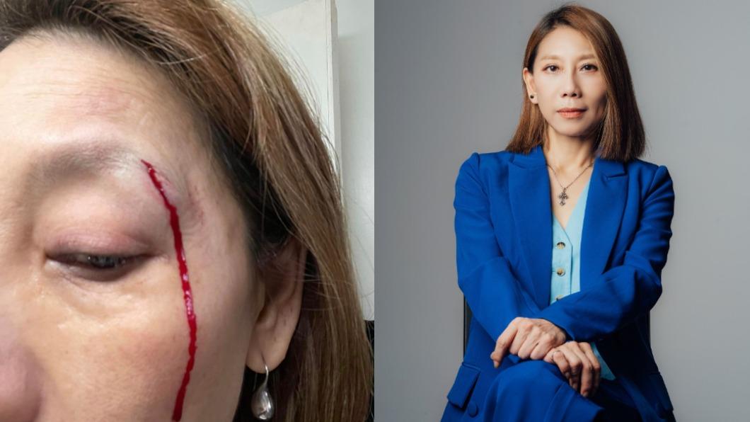 女星遛狗出事了!撞傷濺血驚喊「看見肉」 縫11針最新狀況曝