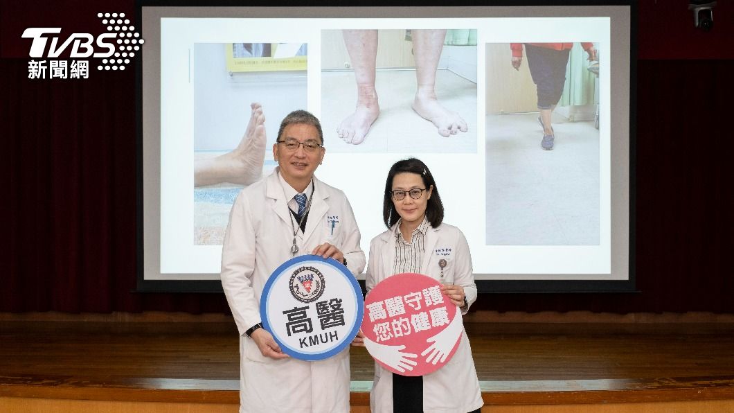 高醫全人工踝關節置換手術使用第四代人工踝關節。(圖/高醫提供)