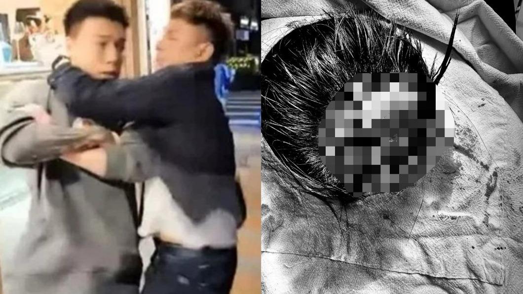 Toyz遭痛毆露面!「血淋淋高清照」曝光 超哥猛揍怒飆:把你殺了