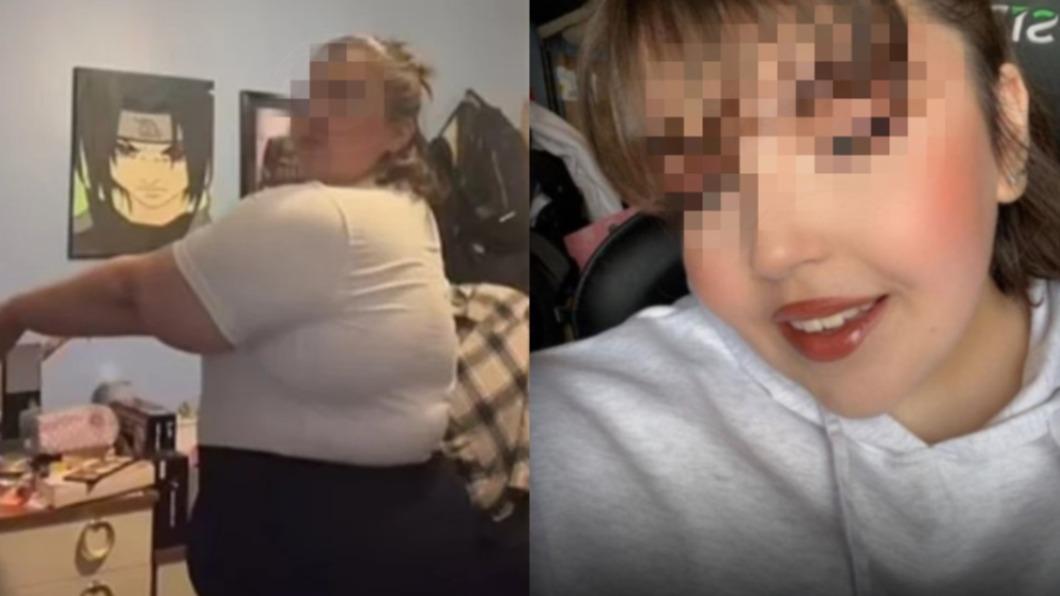 縮胃手術「割破小腸」!搭機途中慘休克 妙齡女命喪南歐