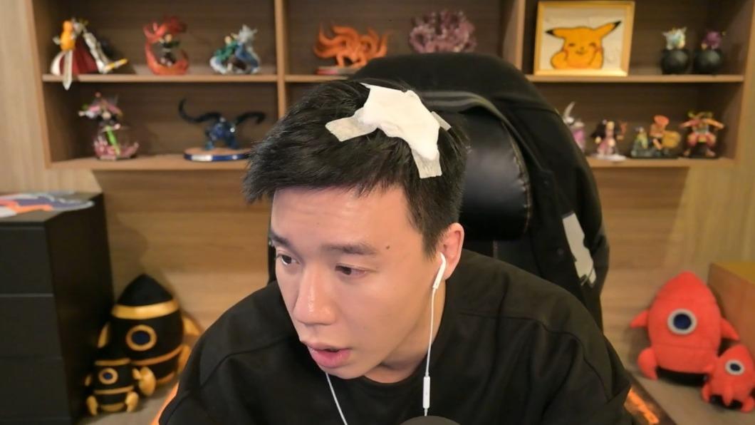 Toyz在頭被打破後,26日晚間首度開直播回應。(圖/翻攝自浪Live)