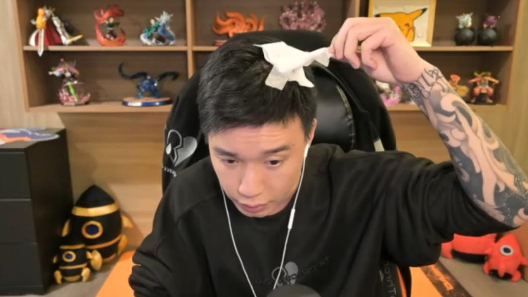 Toyz多災多難原因找到了!「眉尾有痣」命理師搖頭:快點掉