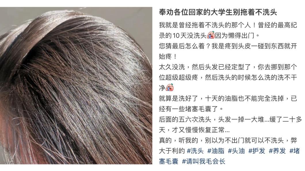 原PO因連10天沒洗頭而毛囊阻塞,不但一碰頭皮就痛,甚至還嚴重掉髮。(圖/翻攝自「請叫我毛會長」小紅書)