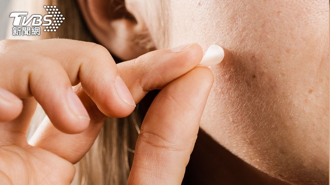 不是每種痘痘都有效!痘痘貼4使用地雷 「全新型態」打破限制