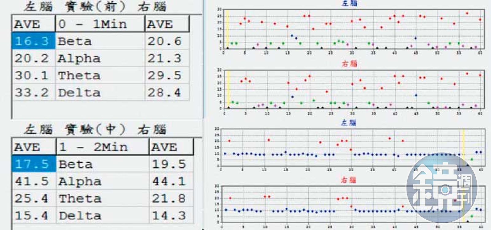 經10分鐘「調整」,業者秀出圖表告訴記者,「焦慮腦」的問題有明顯改善。(圖/鏡週刊)