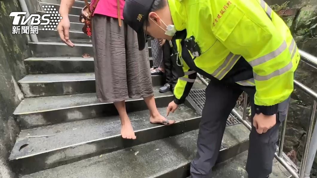 屋主的女兒左腳燙傷。（圖／TVBS）