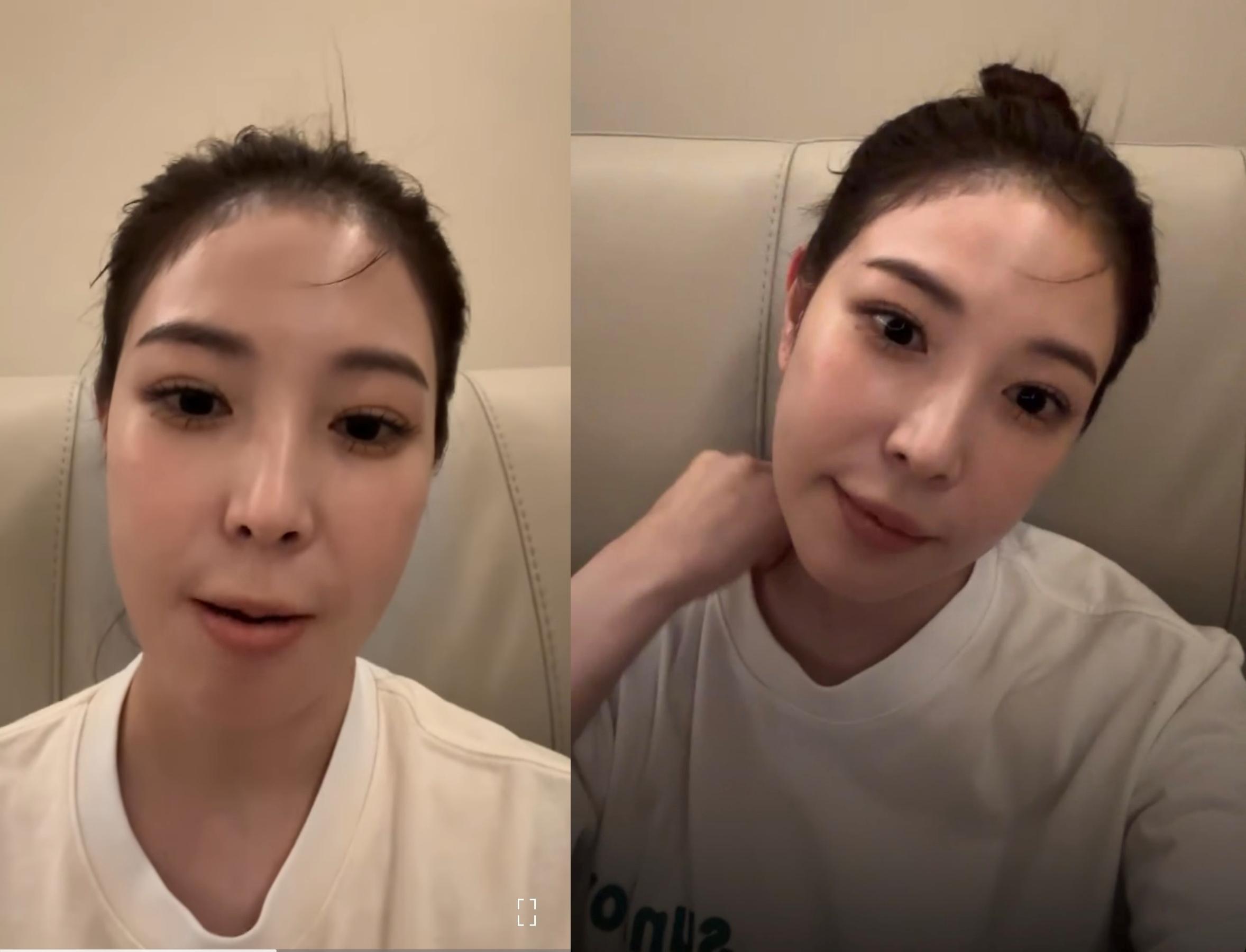 BoA稱是因為最近常咬嘴巴才會看起來很腫。(圖/翻攝自BoA IG)