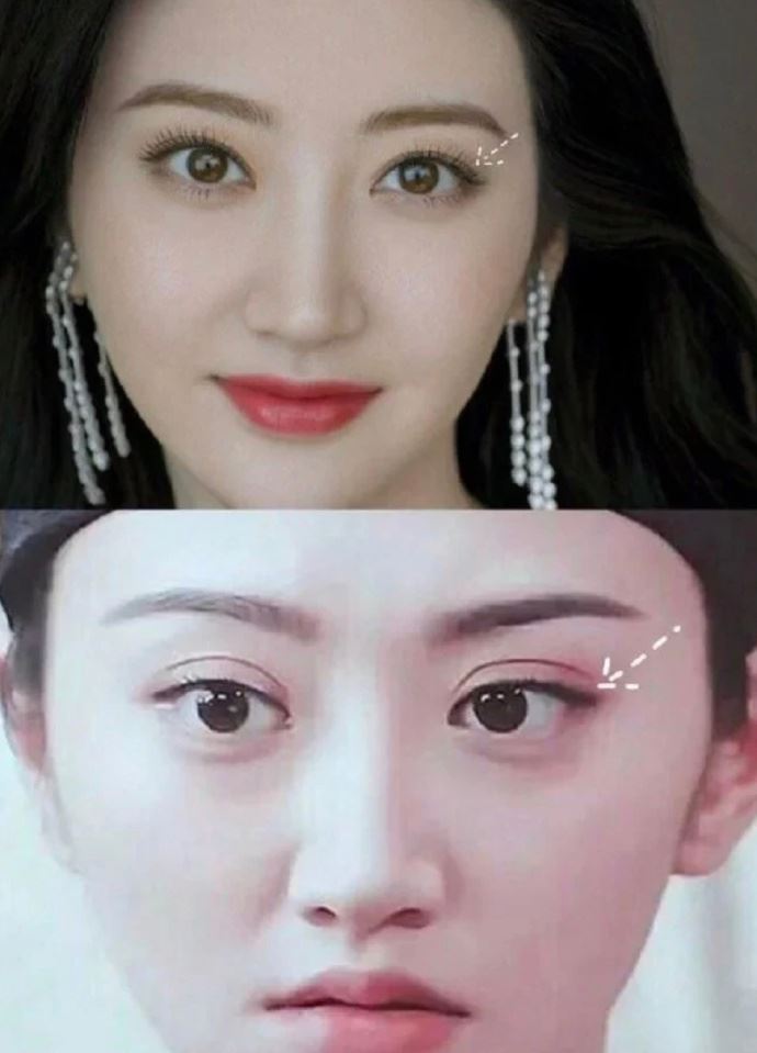 景甜如今的雙眼皮顯得浮腫。(圖/翻攝自微博)
