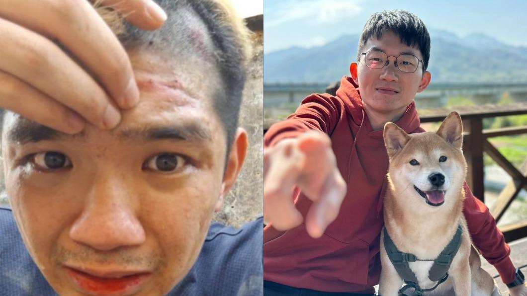 還以為是晚安小雞!視網膜「衣服來不及剪」崩潰追跑 情人節爆驚魂