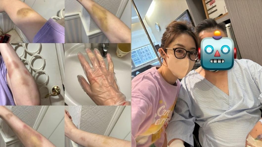 林千又公開全身傷慘照。（圖／翻攝自IG＠cocomademedomydream）