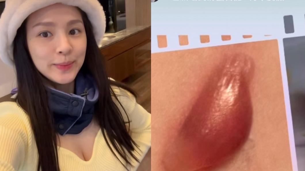 熊熊才剛生女兒!大腿長出「巨型水泡」 親揭背後原因