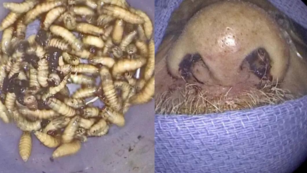 嘴腫鼻血狂流!男鼻內竟住「150隻活蟲」 超噁狂蠕驚呆醫