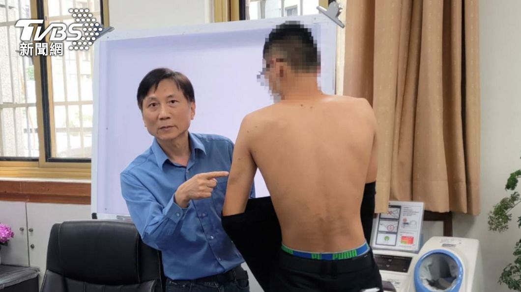 甩棍凌虐滿身傷!桃警刑求17歲少年 持電擊棒還戲謔:武器來了