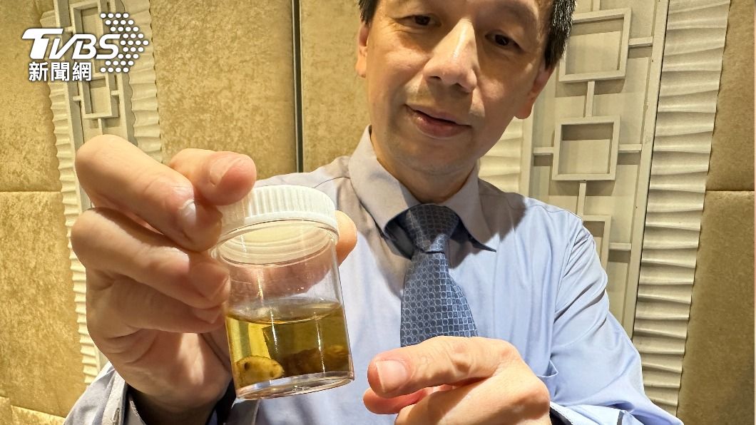 有圖／男去秘魯被叮！罕見蟲寄生嘴唇孵化亂鑽　手術夾出3幼蟲