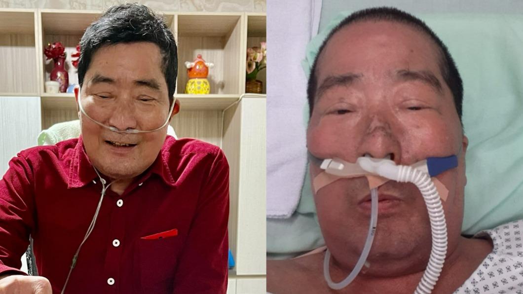 《戲說》男星猝逝享年71歲!友慟揭死因 生前公開插管照惹鼻酸