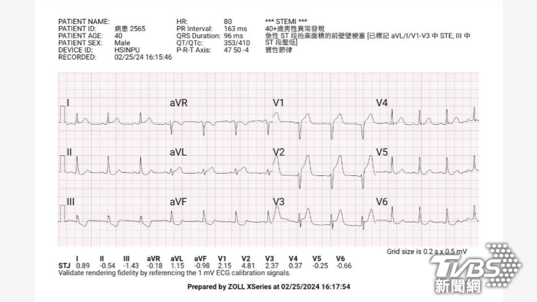 救護人員以十二導程心電圖機監測。(圖/TVBS)