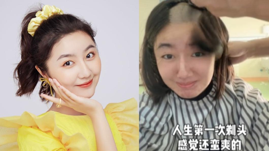 22歲「最紅童星」罹患罕見腦瘤 今動開顱手術曾勸:千萬不要熬夜