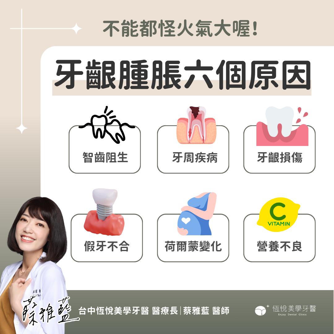 牙齦腫脹六大原因。(圖/翻攝自蔡雅藍醫師臉書)